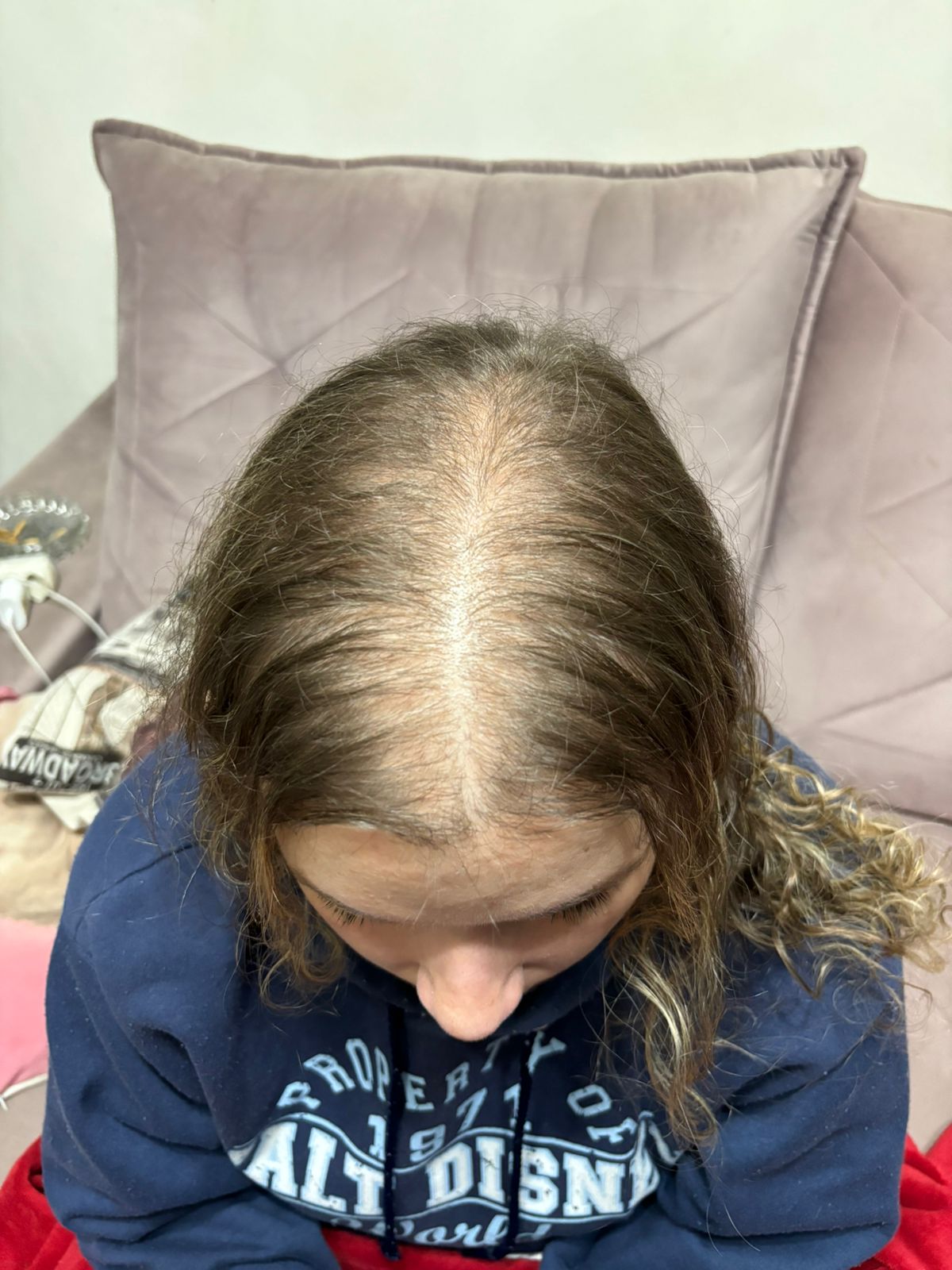 Linha central do cabelo antes