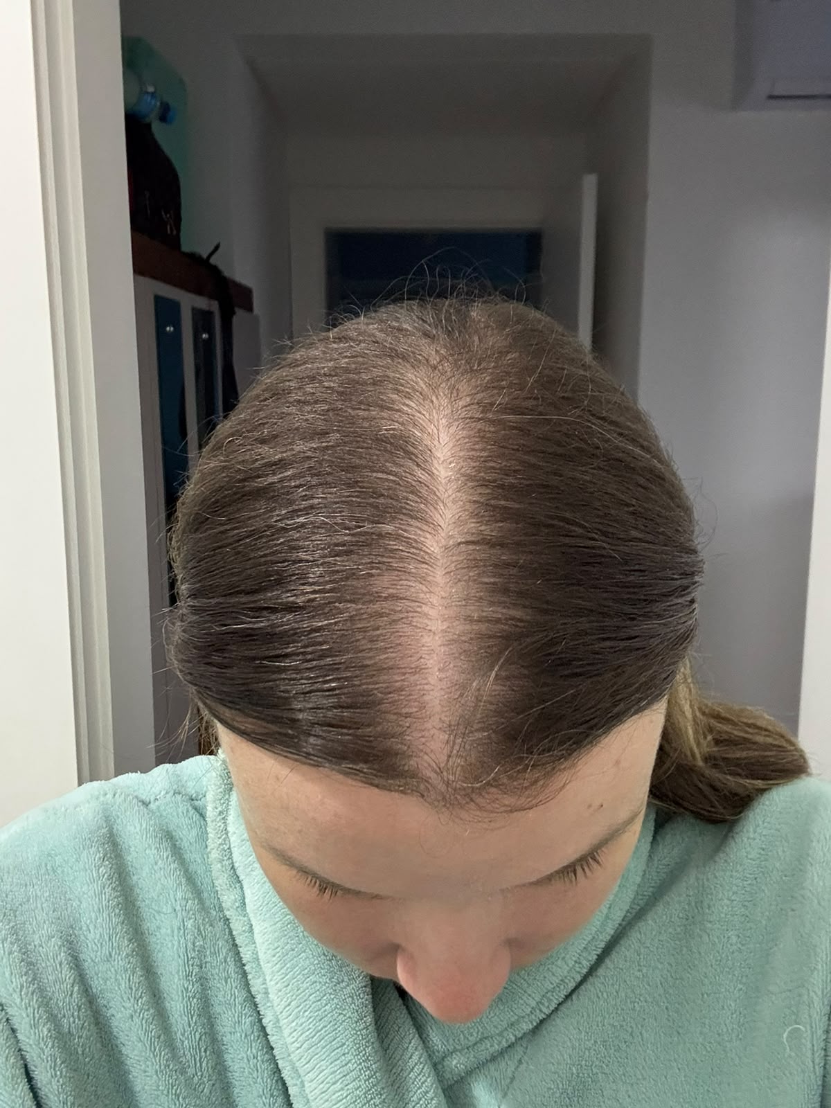 Linha central do cabelo depois